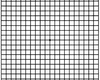 A black and white grid pattern is shown.