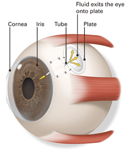 A close up of an eye with the parts labeled.